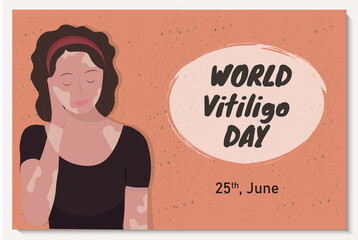 Banner with beautiful young woman with vitiligo desease, flat vector illustration
