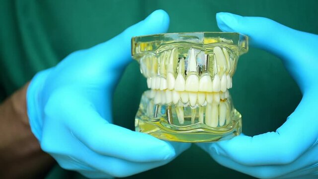 Close-up photo of implant dentistry it is a replacement for missing teeth by dentist hand.