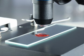 Glass slide with sample of red liquid under microscope in laboratory, closeup