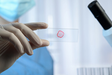 Scientist holding microscope slide with red sample in laboratory, closeup