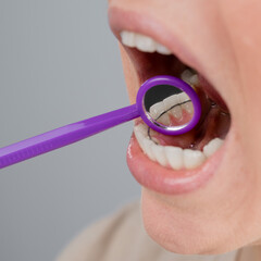 Close-up portrait of a woman with internal braces and a dental mirror. The girl corrects the bite