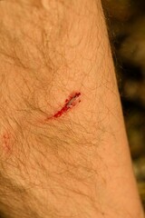 close up of a blood on a skin