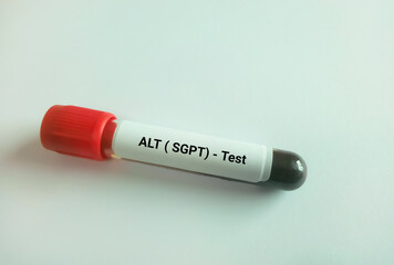 Blood sample isolated with copy space for ALT (SGPT) Test. Liver function test