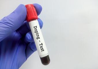 Doctor holding test tube with blood sample for Doping test, copy space. closeup. Doping control