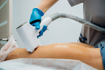 The procedure of laser hair removal of women's legs. Application of sugar paste for the sugaring procedure.