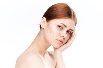 Fototapeta premium sad woman with bare shoulders red dots on her face