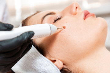 Professional salon procedures. Surgeon using a laser device for removing mole. Removal of birthmark from female face. Close up. Concept of laser cosmelotogy and electrocoagulation - obrazy, fototapety, plakaty