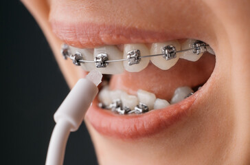 Smiling young woman with braces cleaning her teeth with oral irrigator, close-up. Dental hygiene...