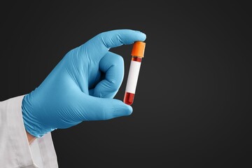 COVID-19 positive, blood sample tube in a hand