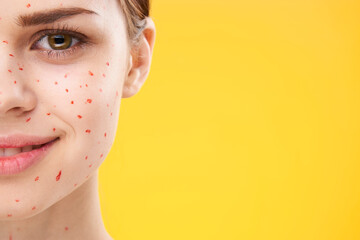 woman with red dots on her face skin problems dermatology dissatisfaction