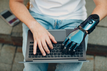 Young disabled man with artificial prosthetic hand using typing on laptop computer keyboard