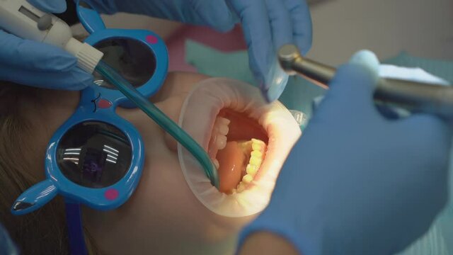 a little girl with an oral dilator at the dentist's appointment. 