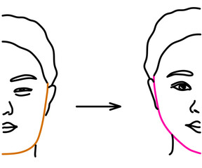 Woman face on isolated background. Plastic surgery. Vector illustration.