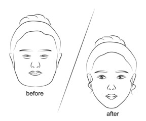 Woman face on isolated background. Plastic surgery. Vector illustration.