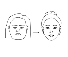 Woman face on isolated background. Plastic surgery. Vector illustration.