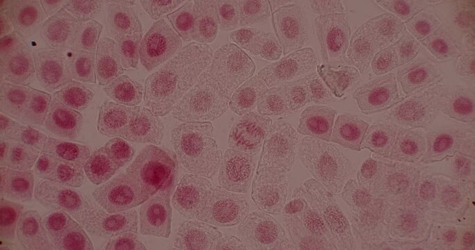 Root tip of Onion and Mitosis cell in the Root tip of Onion under a microscope.
