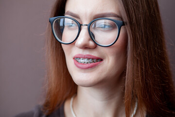 The smile of a young and beautiful girl with braces on her white teeth. Straightening of crooked...