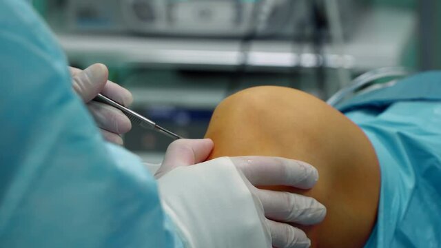 the surgeon makes an incision in the knee joint to place the camera