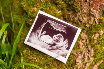 An echo of a baby on a tree, pregnant session in a forest