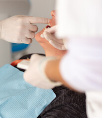 paciente es sometido a una intervención odontológica en una clínica dental  - obrazy, fototapety, plakaty