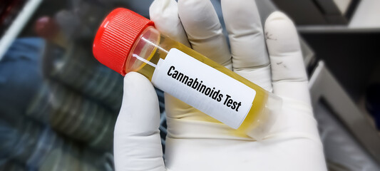 Urine drugs test sample for Cannabinoids or DAST or Marijuana drug test, to determine presence of...