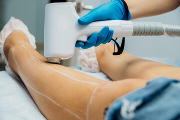 The procedure of laser hair removal of women's legs. Application of sugar paste for the sugaring...