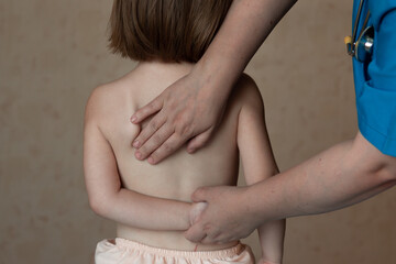 Fototapeta premium Little girl 3 years old at a massage session with a specialist. Muscle tone. Children's massage. Scoliosis. Close-up of the back and arms. Copyspase.