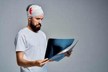 Man head injury radiology treatment health care