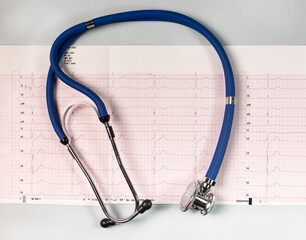 Cardiogram background through magnifying glass, cardiology. ECG and stethoscope.