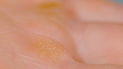 MACRO, DOF: Callouses formed on the palm of an unrecognizable male climber.