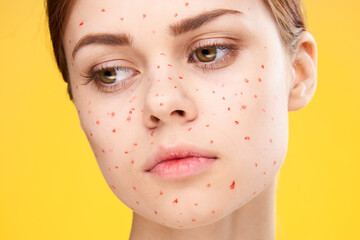 woman with red dots on her face skin problems dermatology dissatisfaction