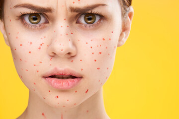 woman with red dots on her face skin problems dermatology dissatisfaction