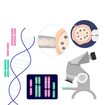 Vector colored illustration of PGD preimplantation genetic screening of embryon or morula oocyte