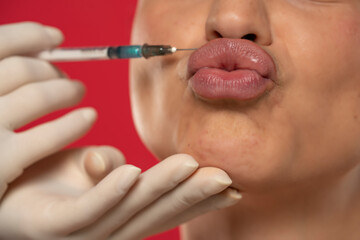 Close up of a young funny woman on a face filler injection procedure