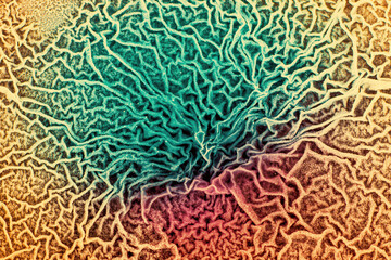 The tissue of a biological organism is affected by two types of cancer cells. Electron microscopy....
