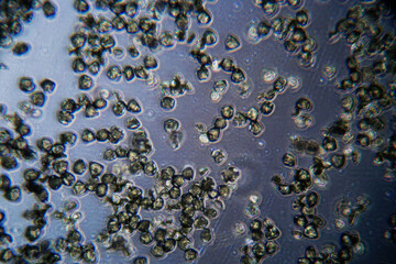 pollen particles as an allergy factor