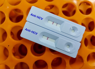 Rapid test cassettes isolated on test tube tray for Hepatitis C virus showing both positive and...