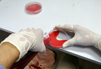 Medical Tecnologist pouring sheep blood into petri dish which is then use for microbial culture.