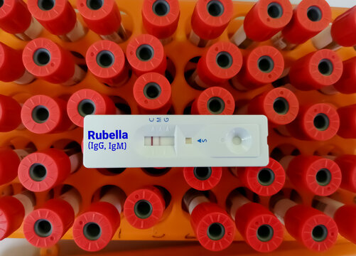 Rapid test cassette for Rubella Virus rapid screening test  isolated, showing positive IgG result.