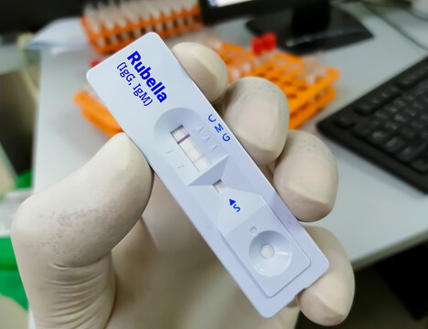 Close view of technician or technologist hand hold a device of Rubella Virus rapid screening test, showing positive IgG result.