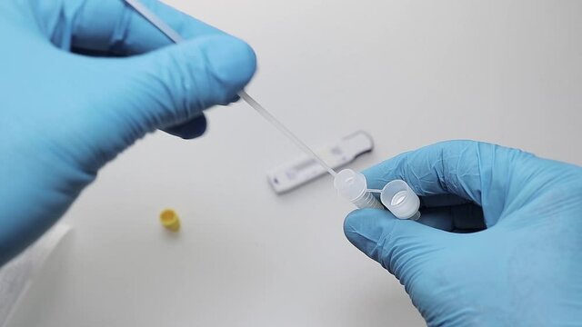Abstrich Testtupfer wird in das R&ouml;hrchen mit Testfl&uuml;ssigkeit getunkt.