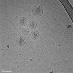 Nanoparticles made of lipids (liposomes) containing an anticancer drug (doxorubicin)