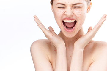 sad woman with bare shoulders red dots on her face