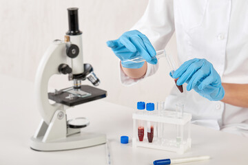 Fototapeta premium the hands of a laboratory assistant transfusing blood into a test tube with a solution