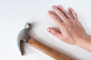 a hand and a hammer on a light background. A finger with a blue nail from a hammer blow