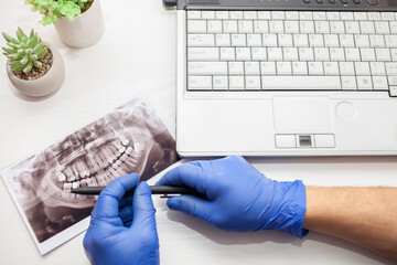 dentist in clinic examines x-ray of jaw of client's patient's teeth. modern technologies. close up