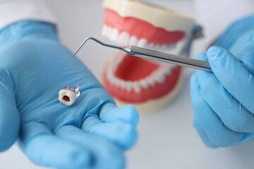 Dentist doctor holding artificial plastic tooth in his hands on background of jaw closeup