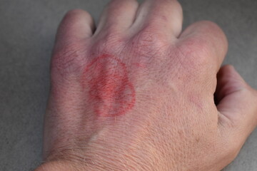 Stamp Emblem on a Hand