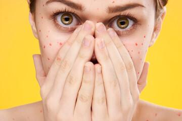 woman with red dots on her face skin problems dermatology dissatisfaction