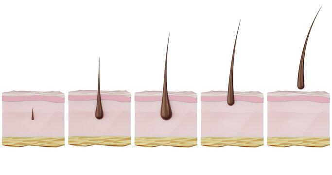 3d illustration of the stages of the recovery cycle hair growth hair loss, baldness, alopecia, hair removal. Hair growth, care, strengthening, removal, hair loss